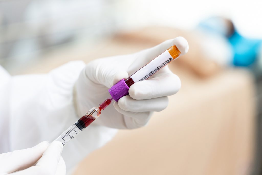 Testes hormonais: quando e por que os homens devem fazer